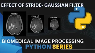 Stride effect Gaussian filter Code implementation Biomedical Image Processing