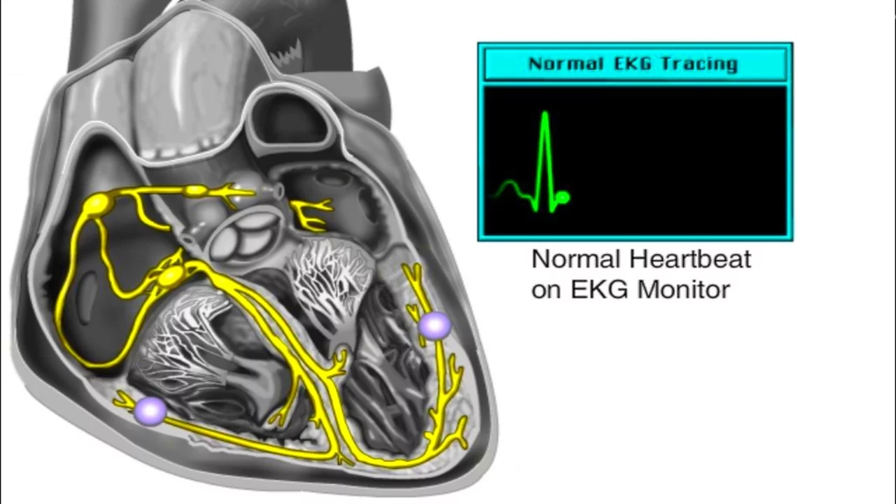 Cardiac Conduction System Animation | The Heart's Electrical Wiring