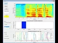 Real Time Speech Emotion Recognition Using Deep Neural Network