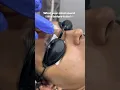 Transform your skin with the Fire and Ice Facial Resurface Rejuvenate Renew