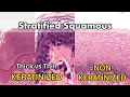Keratinized vs Non Keratinized Thick vs Thin