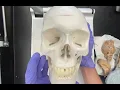 Comparative Anatomy Sheep Human Brain Sheep Brain