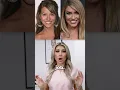 What cosmetic procedures has Chrishell Stause had done