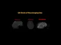 Quality Checks for fMRI Data