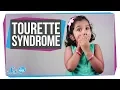 Download Lagu Tourette Syndrome: What Makes People Tic?