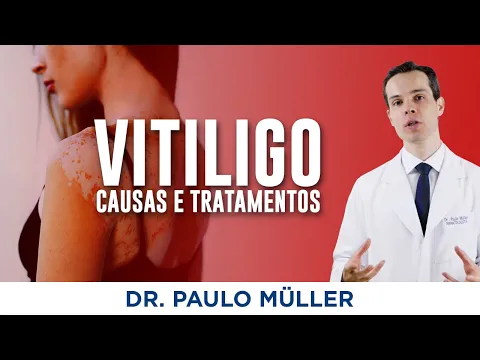 Download MP3 Vitiligo - O que você precisa saber sobre essa doença! - Dr. Paulo Müller Dermatologista