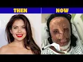 10 Celebrity Plastic Surgery Disasters You Won t Believe CAROL BRYAN DENNIS AVNER LYN MAY