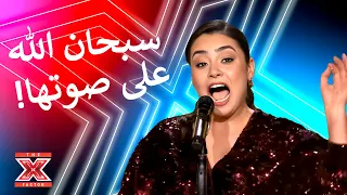 ردة فعل عبدلله رويشد لم تكن متوقعة ابدا    اكس فاكتور الموسم   الحلقة   دندنها