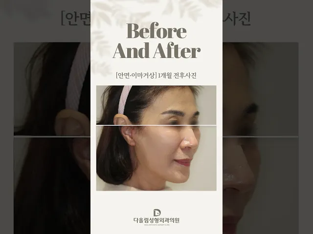 YouTube 영상
