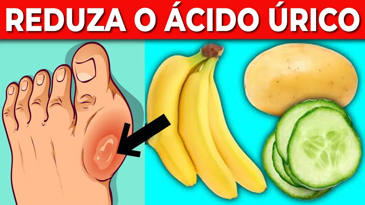 9 Alimentos que Reduzem Drasticamente os Níveis de Ácido Úrico