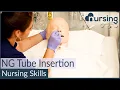 NG Nasogastric Tube Insertion Techniques Nursing Skills