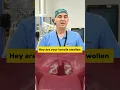 Get your tonsils removed because