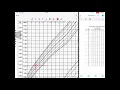How to interpret BP chart in pediatric age group MedEd series 1