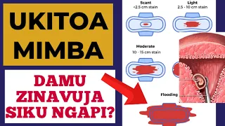 Kutoa Mimba Damu Zinavuja Siku Ngapi Mimba 