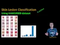 203 - Skin cancer lesion classification using the HAM10000 dataset