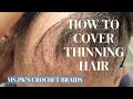 How To Cover Thinning Hair Ms Pk s Crochet Braids