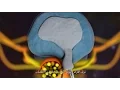 Lumbar Disc Removal