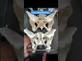 Pelvis identification