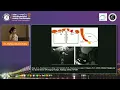AMS2026 DAY1 HALL C 5 Athletic Pubalgia A Structured Imaging Approach to Core and Groin Pain