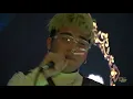 MSTRYO FULL SET