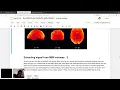 Tutorial on machine learning in functional MRI using Nilearn