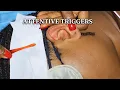 Download Lagu ASMR ~ Deep Ear Cleaning 🧼 | Intense Tingles \u0026 Personal Attention for Sleep and Stress Relief 😮‍💨 