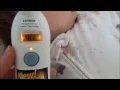 Lagu Exergen Temporal Artery Thermometer with Smart Glow
