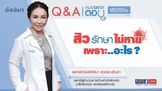 ทำไมสิวถึงเป็นเรื้อรัง ไม่หายแม้ไปกดบ่อยๆ