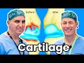 How To Grow Your Cartilage Can We Actually Do It