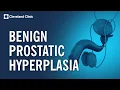 What Causes An Enlarged Prostate BPH Explained