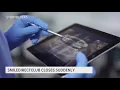 SmileDirectClub shuts down suddenly leaves patients with questions