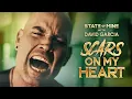 STATE of MINE - Scars On My Heart (Official Music Video)