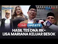 Download Lagu 🔴LIVE UPDATE | Polri Pastikan Hasil Tes DNA Ridwan Kamil-Lisa Mariana Bakal Keluar Besok