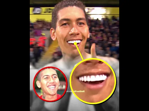 What teeth do footballers have? 😁