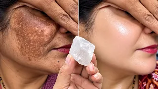 गारंटी है, 💯 1 ही बार में, झाइयां हटा के, बहुत गोरा कर देगी,10₹ की फिटकरी