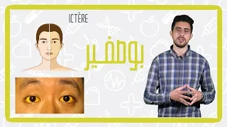 اسباب واعراض بوصفير 