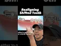 How to Straighten Shifted Tooth to Replace Missing Tooth View Mobile Dental
