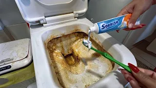 VOCÊ SÓ PRECISA FAZER ISSO 1 VEZ— Meu Primo Dentista Me Ensinou… 