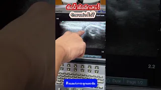  อาการปวดบวมที่ข้อเท้าเกิดจากสาเหตุอะไร และจะรักษาอย่างไร 