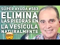 SUPER AYUDA Elimina Las Piedras En La Vesicula Naturalmente