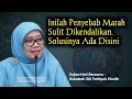 Anjuran Mengendalikan Amarah (Hadits 16) | Ustadzah Siti Fathiyah Khotib