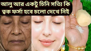 আলু আর চিনি সত্যি ত্বক ফর্সা উজ্বল ধবধবে করে নিন এই ভাবে 