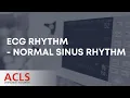 ECG Rhythm Review - Normal Sinus Rhythm ACLS Certification Association