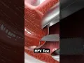 HPV Test 3D Animation
