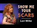 Download Lagu Show Me Your Scars - Lori Wilke