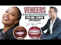 LaTruth Wife Veneers Before and After Procedure