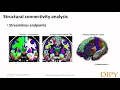Diffusion Tractography Part 3 - Structural Connectivity Analysis