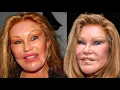 Jocelyn Wildenstein Cat Woman Said This Before Plastic Surgery Death