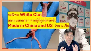 โอกาสที่จะเกิดลิ่มเลือดจากการฉีดวัคซีน mRNA เป็นเท่าไหร่ และเปรียบเทียบกับความเสี่ยงจากโรคหัวใจปกติได้อย่างไร