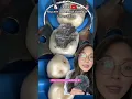 Dentist does a silver filling
